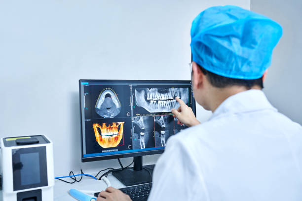 Best Emergency Dentist for Lost Fillings or Crowns in Navarre, FL