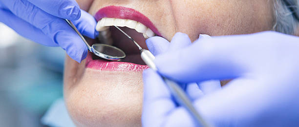 Best Broken or Cracked Tooth Emergency Dentist in Navarre, FL